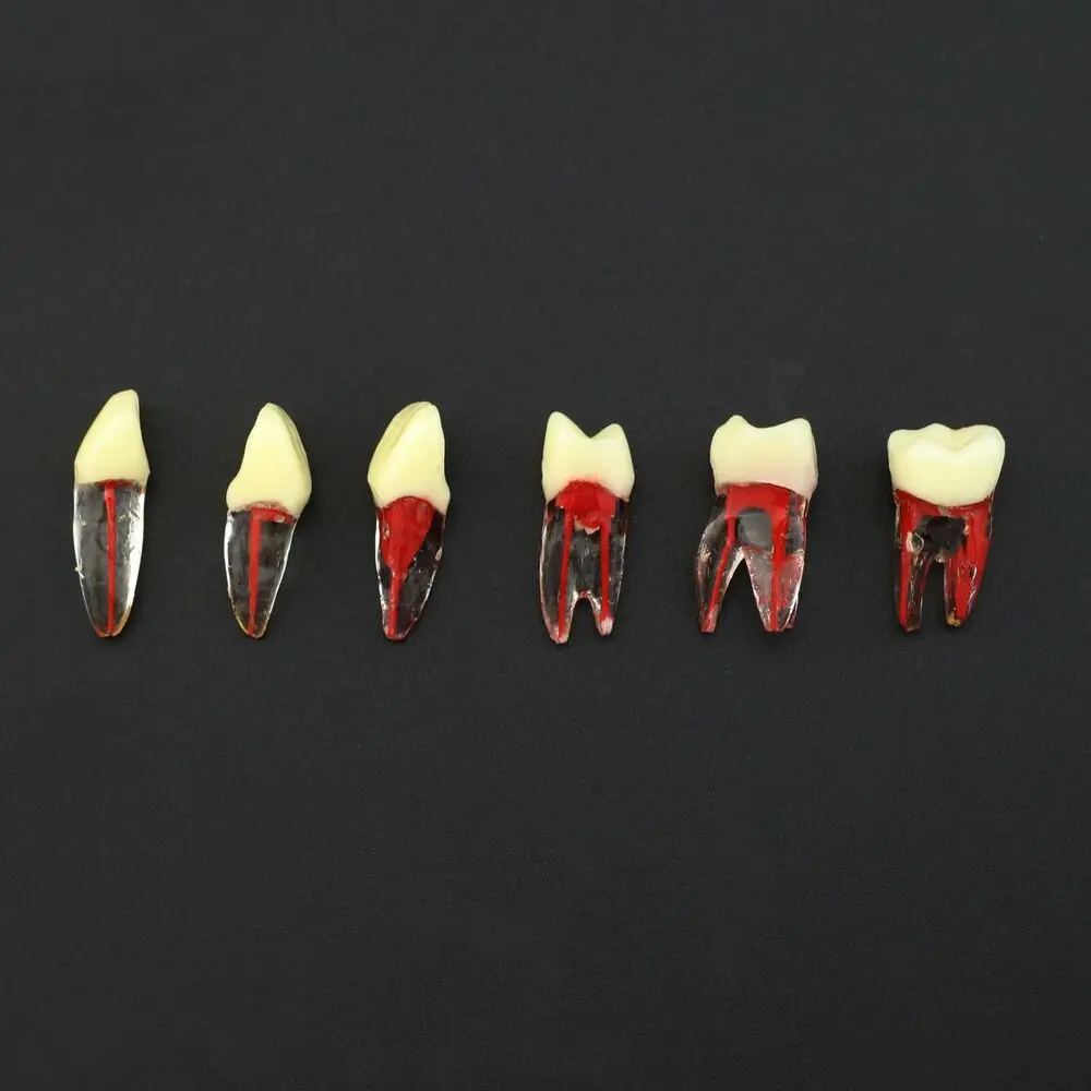 Модел корена на устната маса стоматологична смяна на вида на Kilgore Nissin